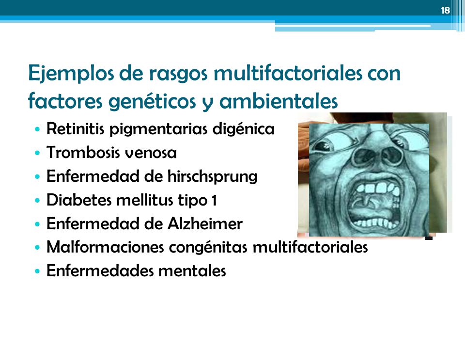 ejemplo de factores genéticos de diabetes tipo 1